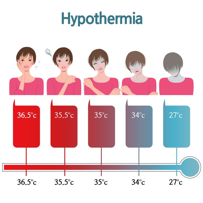 Hypothermia temperature body low cold causes treatment injuries symptoms medical weather wiki january sleightholm keith 11th std gov pedmore temperatures